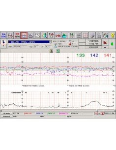 Intellispace Perinatal