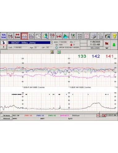 Intellispace Perinatal